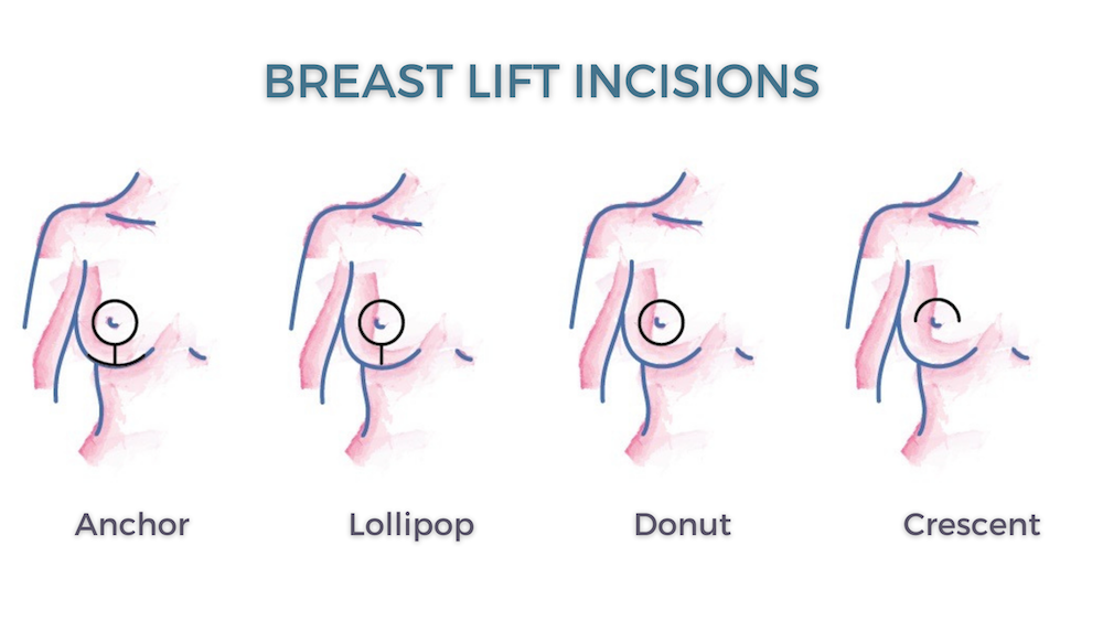 Breast Lift Las Vegas, High Definition Center